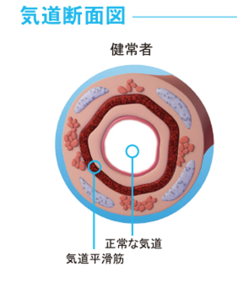 気道断面図 健常者