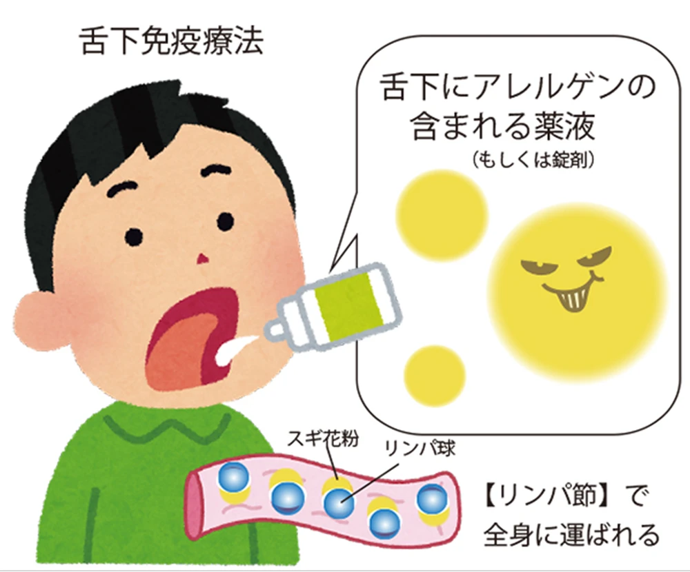 舌下免疫療法01