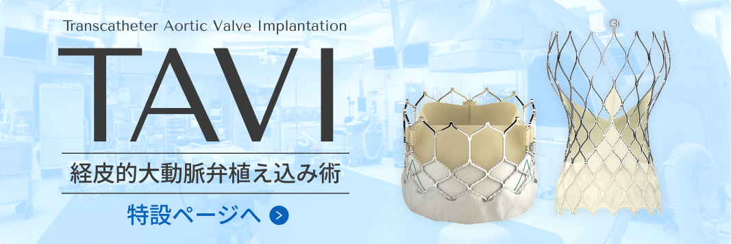tavi