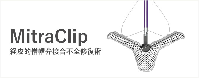 mitraclip