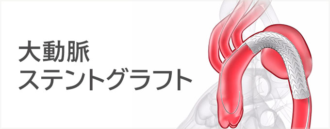 大動脈ステントグラフト